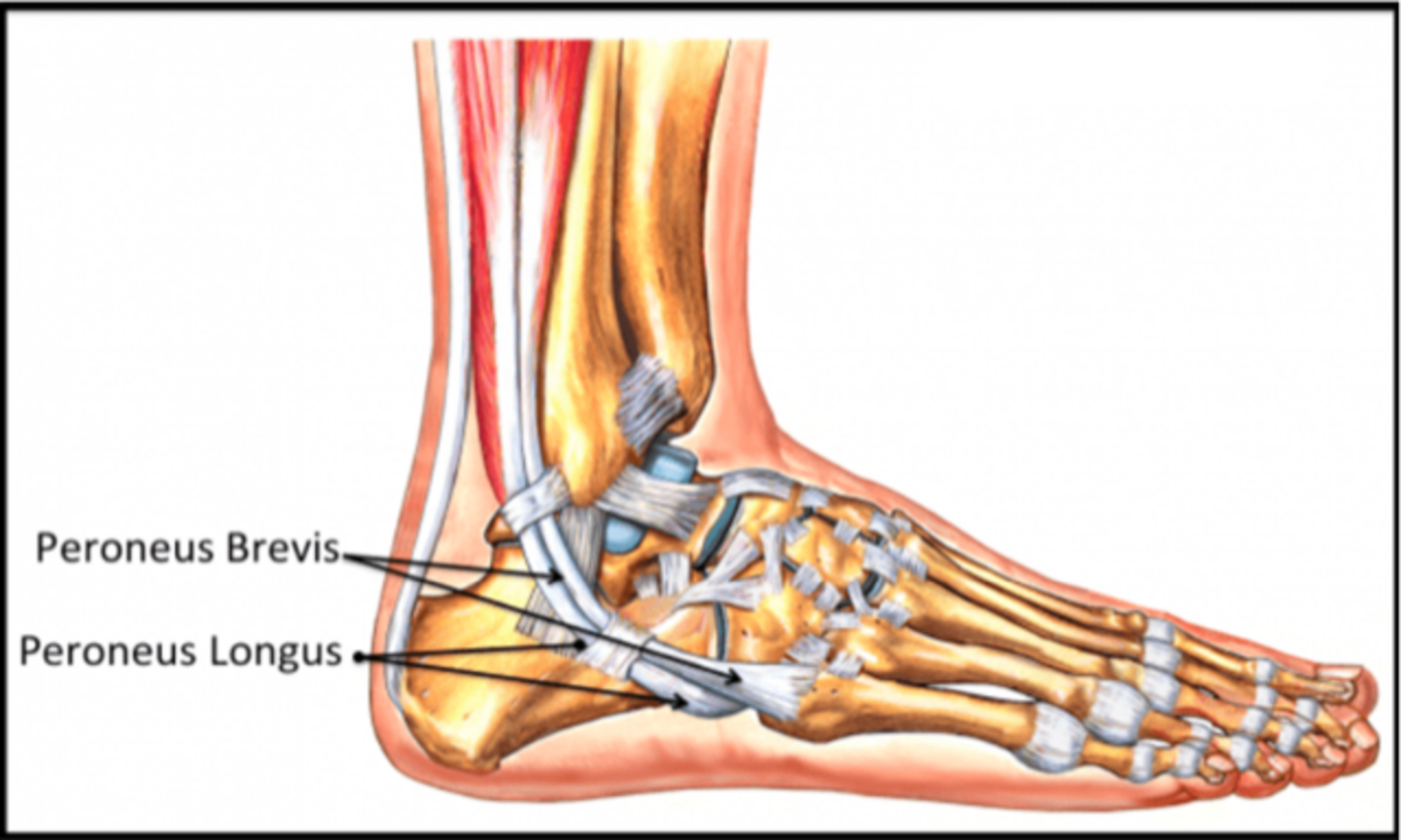 Peroneus Brevis Sehne Längsriss Behandlung www.orthoclinic.be
